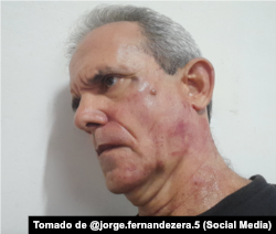 "Un joven teniente coronel de la Seguridad del Estado, supuestamente nombrado Yoán, por decirle cínico y fascista, me dio con todo y lo demostró con creces", denunció Jorge Fernández Era.